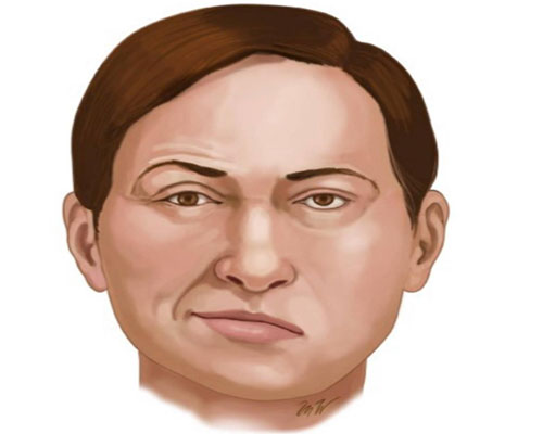 正容堂科普面瘫是什么