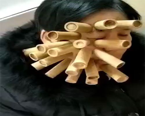 面肌痉挛的早期症状有哪些
