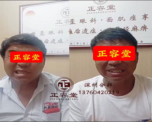 为什么深圳患者选择正容堂？揭秘专业面瘫专科的5大优势