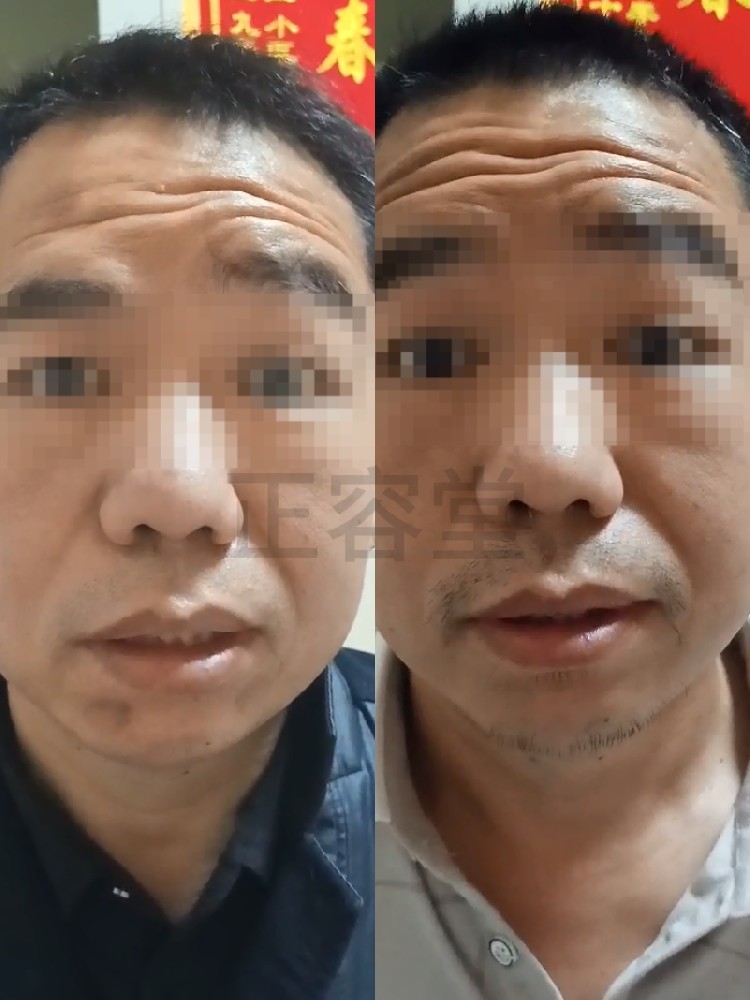retouch_2025100519504386.jpg